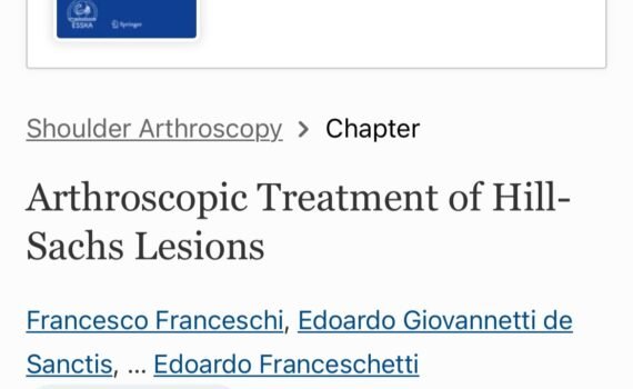 Arthroscopic Treatment of Hill Sachs Lesions
